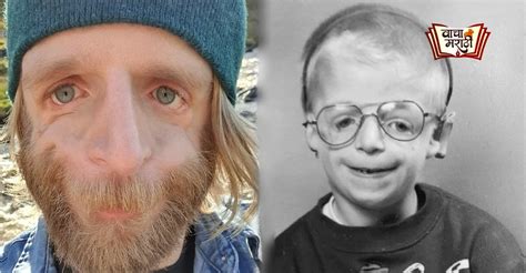 “जन्माच्या ३६ तासानंतर माझ्या आई-बापानं मला सोडून दिलं, कारण मी असा दिसतो”