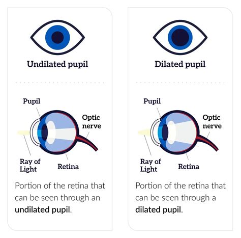 A DEEPER LOOK — Spectacle Optometry