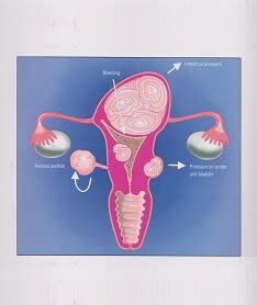 Best Gynec laparoscopic surgeon in Pune , laparoscopic specialist in ...