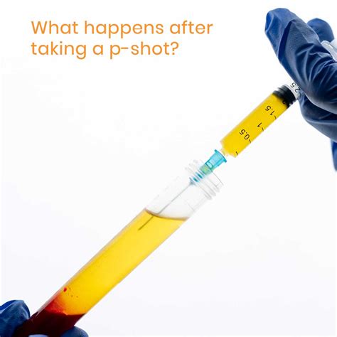 What actually happens during and after the P-shot procedure ...