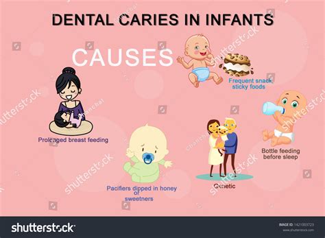 12 Dental Caries Found Images, Stock Photos & Vectors | Shutterstock