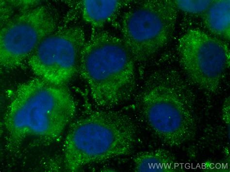 NOXA2/p67phox antibody (CL488-67594) | Proteintech