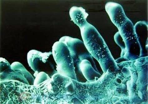 致死率60%的超级真菌，会像新冠一样蔓延吗？ - 知乎