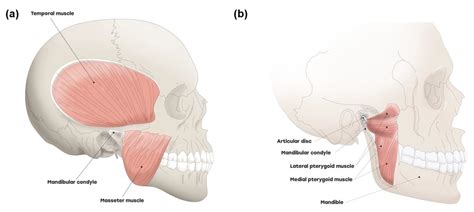 Medial Pterygoid Muscle