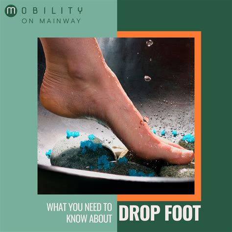 Drop Foot - Causes, Symptoms, Treatments | Mobility on Mainway