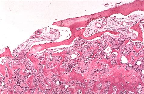 Case 7 - Jacobs School of Medicine and Biomedical Sciences - University ...