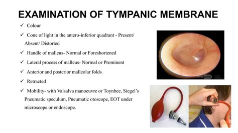 Clinical features of Ear nose and throat | PPTX