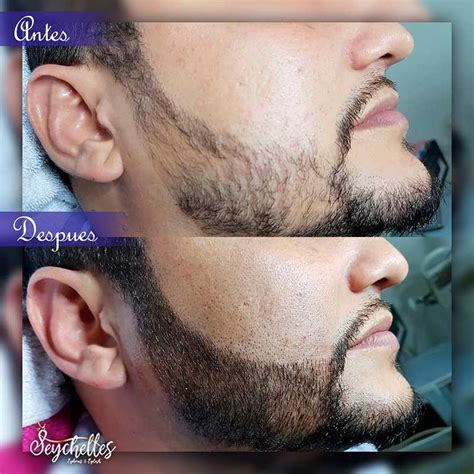 Image result for Microblading Beard