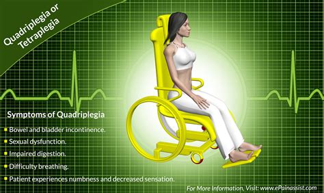 Quadriplegia Tetraplegia Definition Causes Symptoms