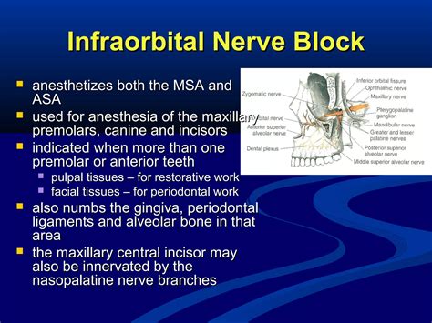 Maxillary Local Anesthesia 的图像结果