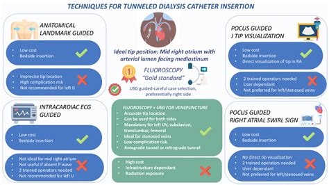 Non-Fluoroscopic Techniques to Insert a Tunneled Hemodialysis Catheter - Kidney International ...