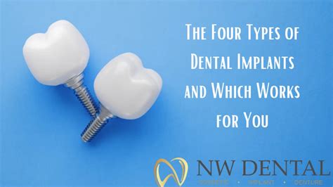 Image result for Different Types of Teeth Implants