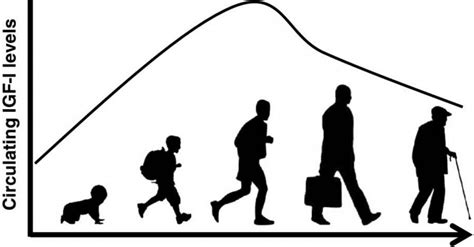 Image result for IGF Insurance