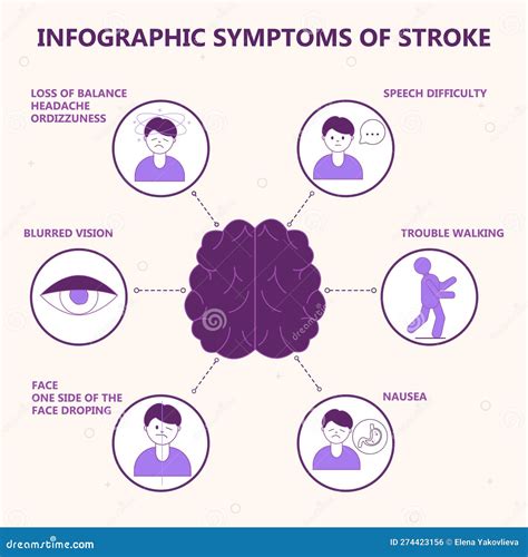 Infografia Dos Sintomas De Acidente Vascular Cerebral. Marca Pode Roxa. Reconhecimento De ...