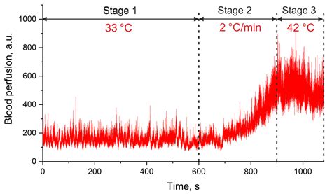 Laser Doppler Spectrum Analysis Based on Calculation of Cumulative Sums ...