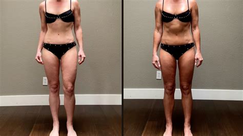 Melanotan 1 vs. 2: My Summer Journey & Real Results - Natural Kaos