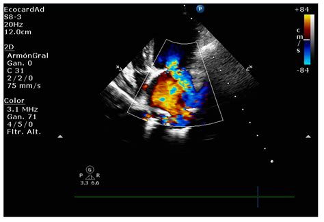 Translational Echocardiography: The Dog as a Clinical Research Model of ...