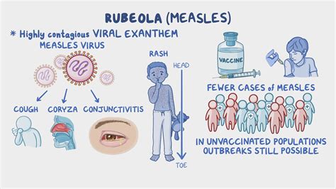 Rubeola Virus