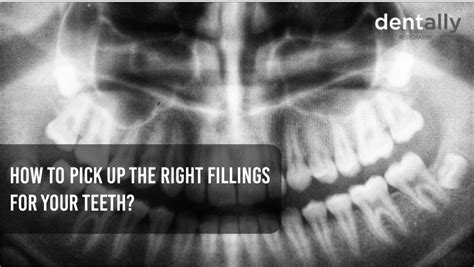 How To Pick Up The Right Fillings For Your Teeth?