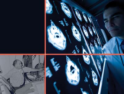 Image result for Radiation Therapy CPT Code