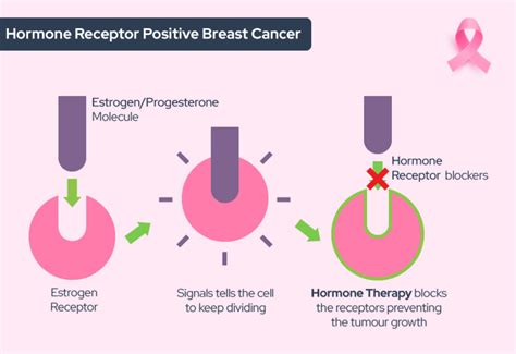 Breast Cancer Subtypes – Hormone Receptor Positive (HR+) Disease | Talking Tatas