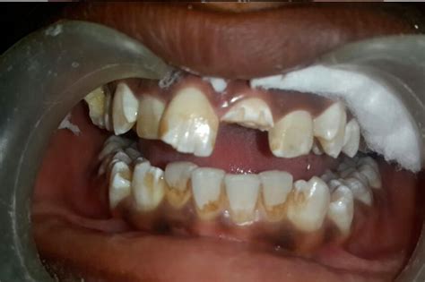 Alagappa Multispeciality Dental Clinic | Dental Clinics in Kumbakonam ...