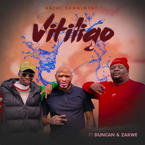 Album De Vitiligo Rare! Vitiligo By KRIZZ KALIKO Signed Autographed - how rare is vitiligo