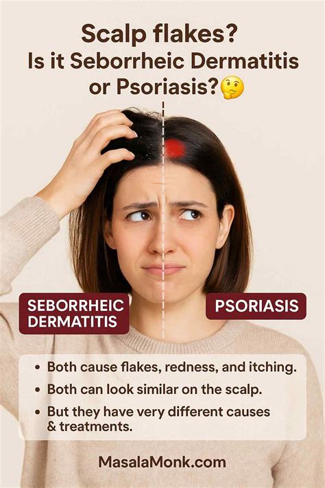 Scalp Psoriasis vs Seborrheic Dermatitis: Differences & Treatment