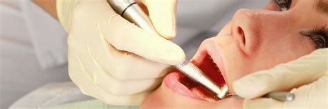 Image result for Post Tooth Extraction