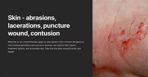Skin - abrasions, lacerations, puncture wound, contusion