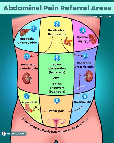 Abdominal pain referral areas generalised overview: | Dr Adarsha Gowda