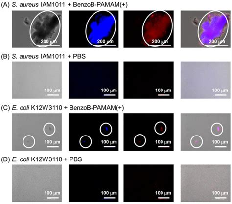 Aggregation-Based Bacterial Separation with Gram-Positive Selectivity ...