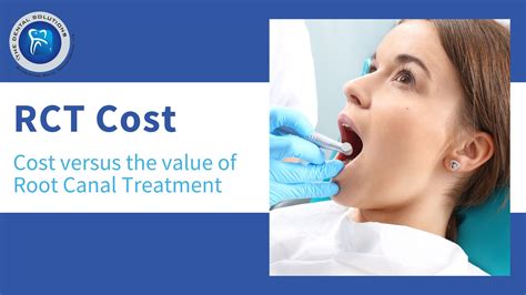 Root Canal Treatment Cost Thane: The RCT of Modern Times