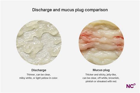 Mucus Plug vs Discharge (pictures): What Does a Mucus Plug Look Like?