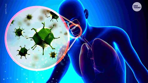 Flu: What you need to know about the contagious respiratory illness