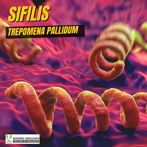Madrid Urología: La Sifilis. Todo lo que debes saber.