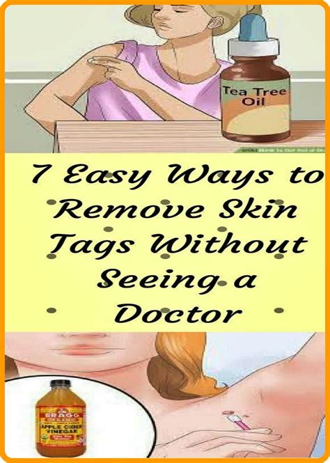 7 easy ways to remove skin tags – Artofit