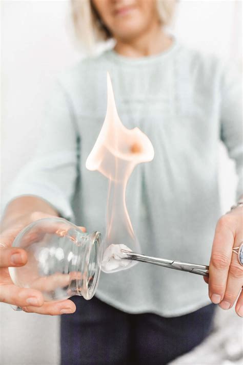 Cupping Therapy on the Sunshine Coast to relief chronic pain