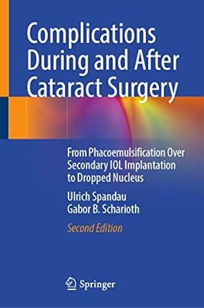 Buy Complications During and After Cataract Surgery: From ...