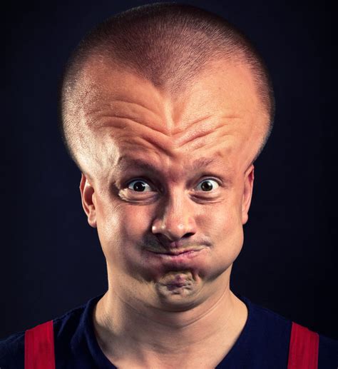 Image result for Exploding Head Syndrome While Awake