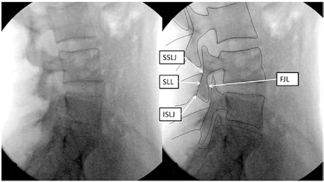 Image result for Contralateral View