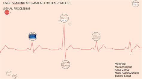 ECG Simulator Using MATLAB 的图像结果
