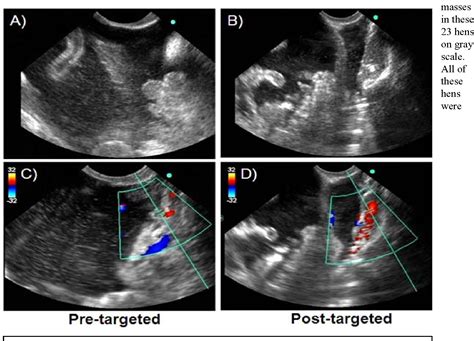 Normal Ovary Ultrasound