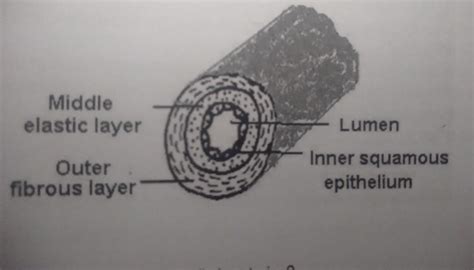 The image shows the structure of an artery.Which statement supports the ...