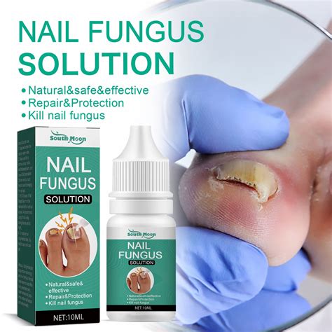 Toenail Fungus Overnight Treatment at Edward Criss blog
