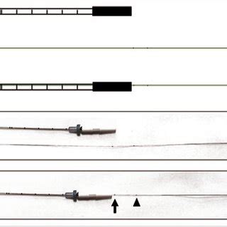 Image result for Wire Loc Procedure