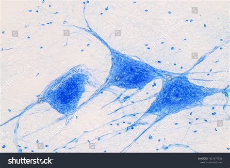 Image result for Brain Under Microscope