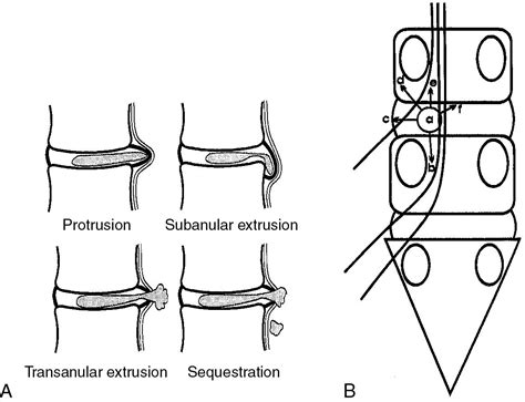 Disk Problem 的图像结果
