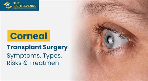 Corneal Transplant Surgery – Symptoms, Types, Risks & Treatment