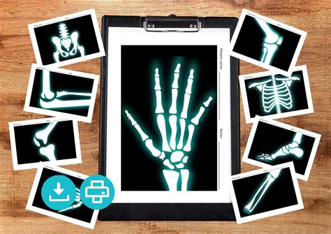 Printable X-rays for Kids. Pretend Play Kids X-ray Activity for Playing Doctors and Nurses ...